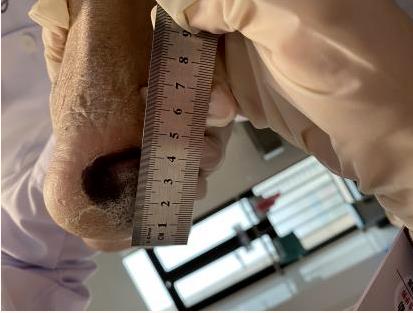 小妲己直播app
（自治区人民医院东院）开展首次护理远程会诊