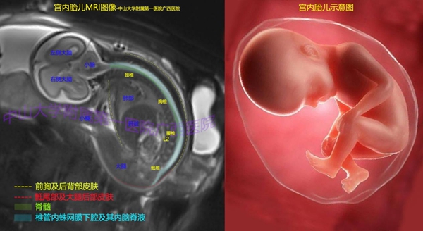 小妲己直播app
首例胎儿磁共振技术检查成功完成