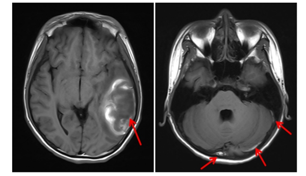 携手破难题 | 小妲己直播app
放射影像科与儿科精准诊断疑难病例