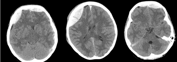 小妲己直播app
神经外科成功抢救颅脑外伤警员